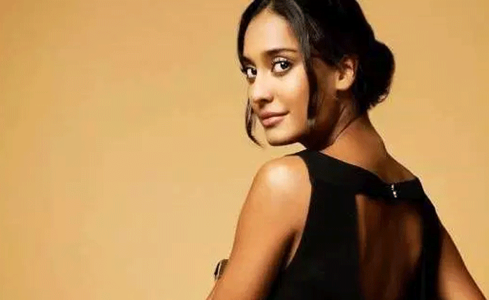 Was picked on for being a toothpick: lisa Haydon