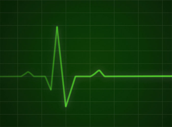 This smartphone app can help detect irregular heart beat