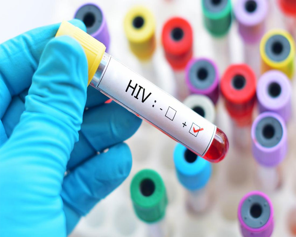 Genetic switch may lead to HIV cure: Study