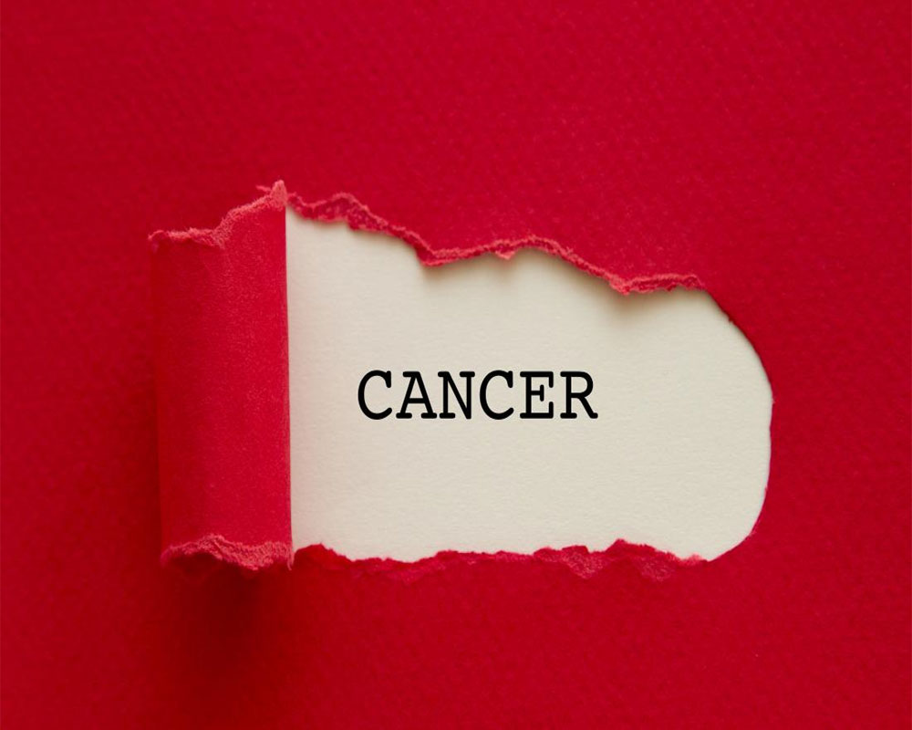 Inflammatory bowel disease ups prostate cancer risk: Study
