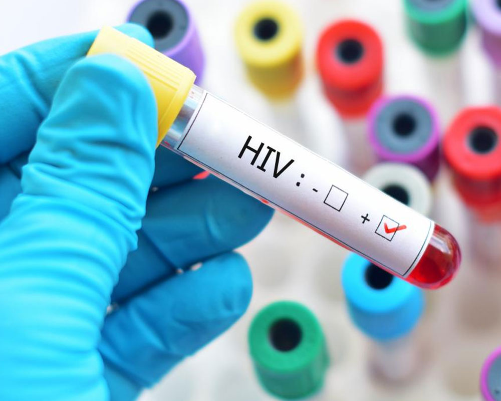 Researchers develop affordable cellphone-based tool to detect HIV