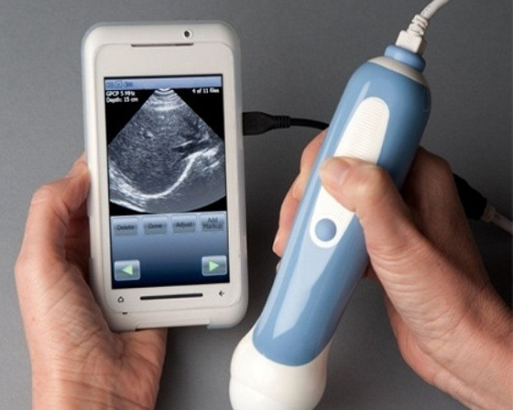 Image result for This smartphone-powered ultrasound machine is cheap, portable