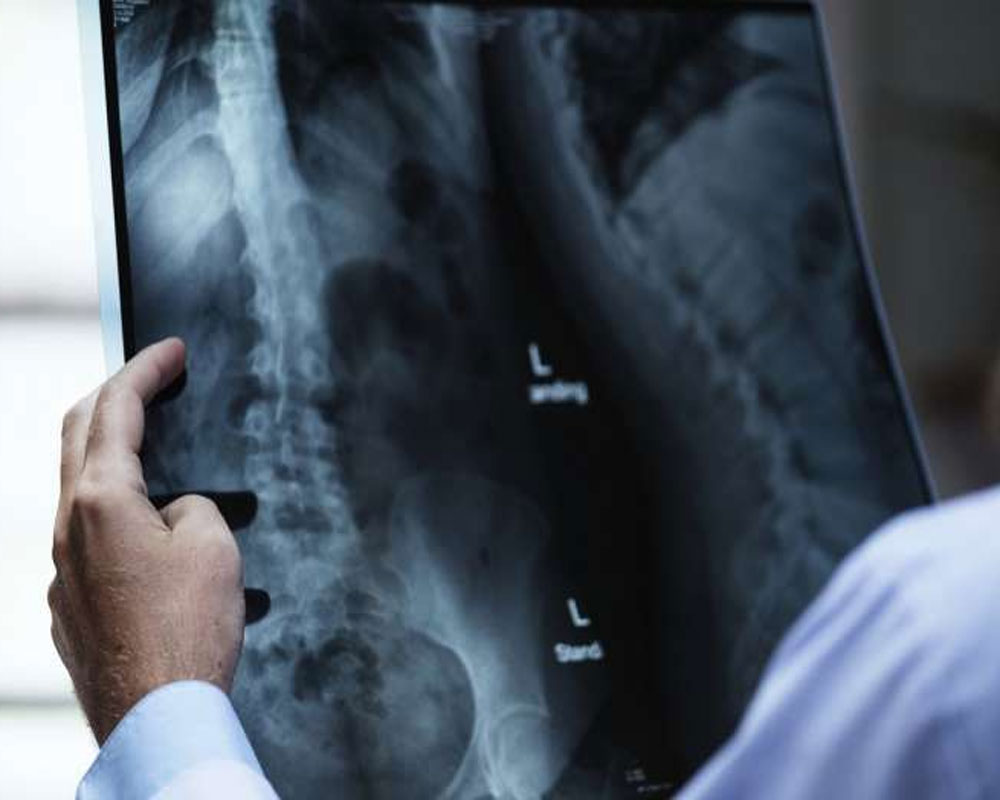 AI can cut time needed to process abnormal chest X-rays