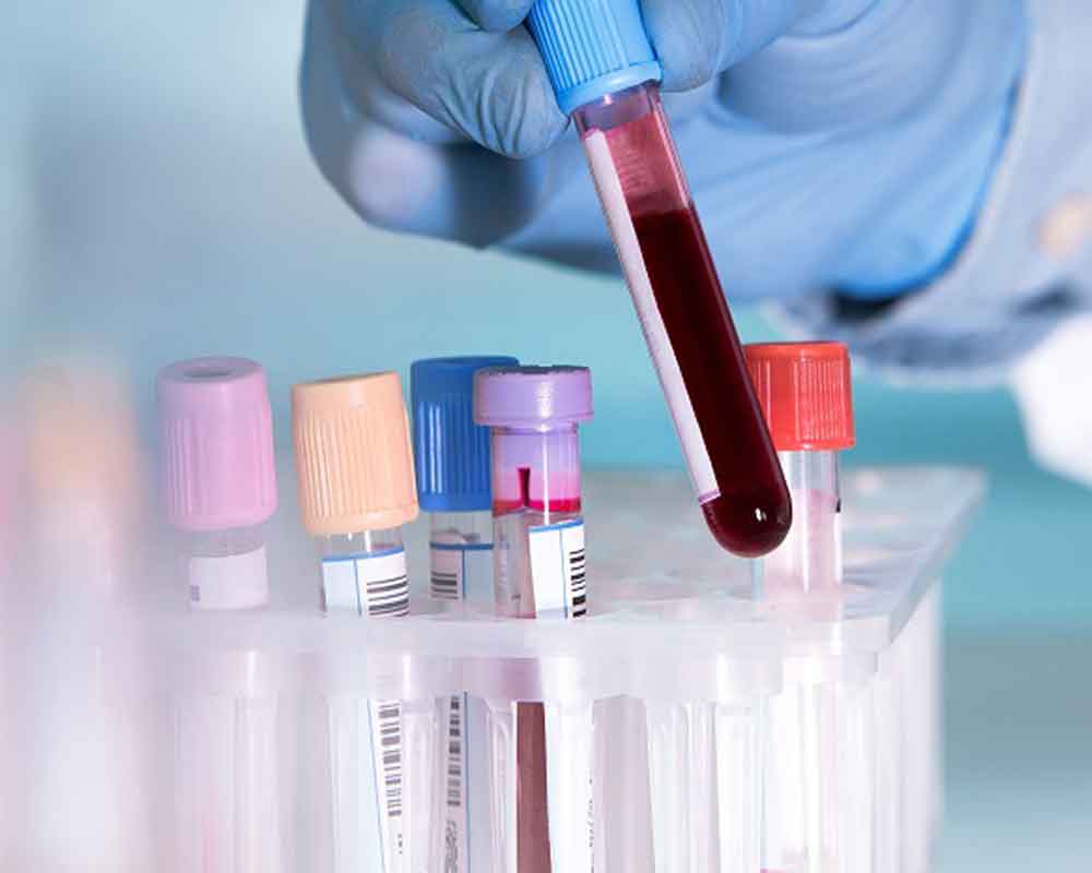 Blood test may predict preterm birth
