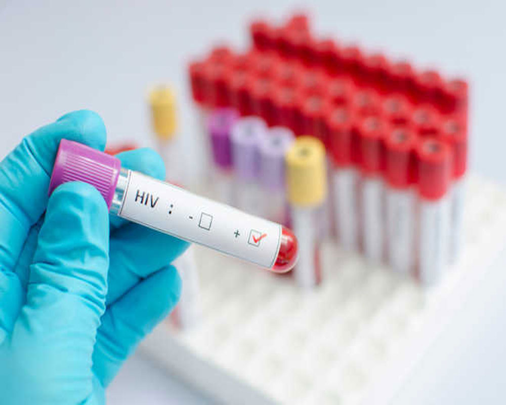 Community-based HIV testing effective in reaching at-risk populations: Study