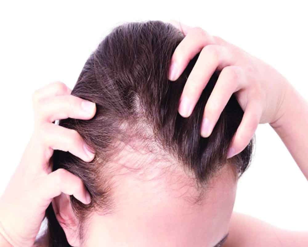 7 common hair loss myths the truth about male pattern baldness