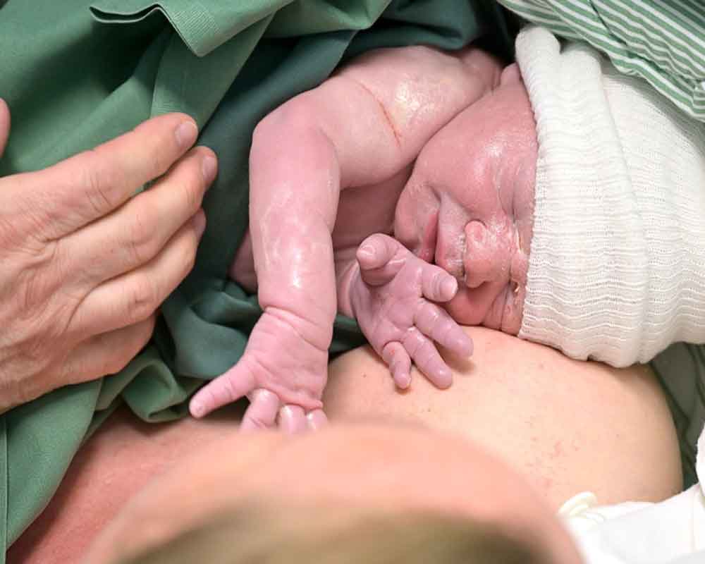 Kids born through C-sections not at higher obesity risk