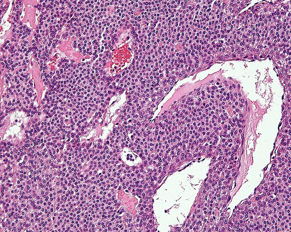 New optical imaging system to help find tiny tumours