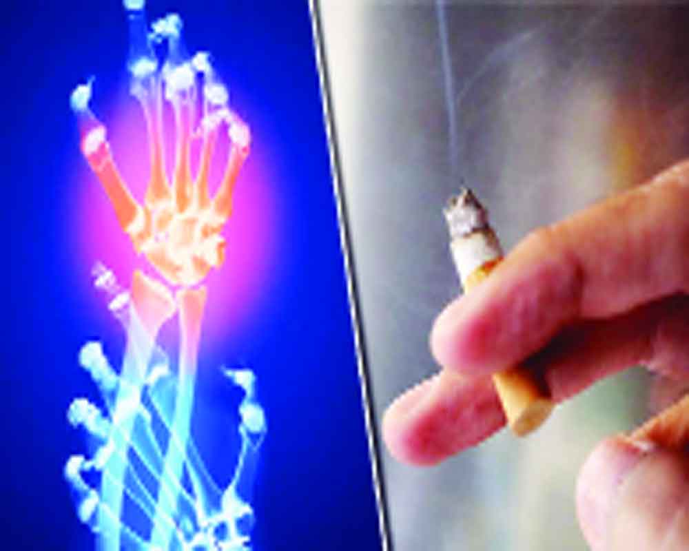 Smoking could lead to rheumatoid arthritis