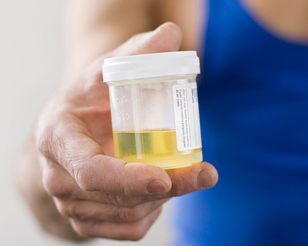 Urine test could help prevent cervical cancer: Study