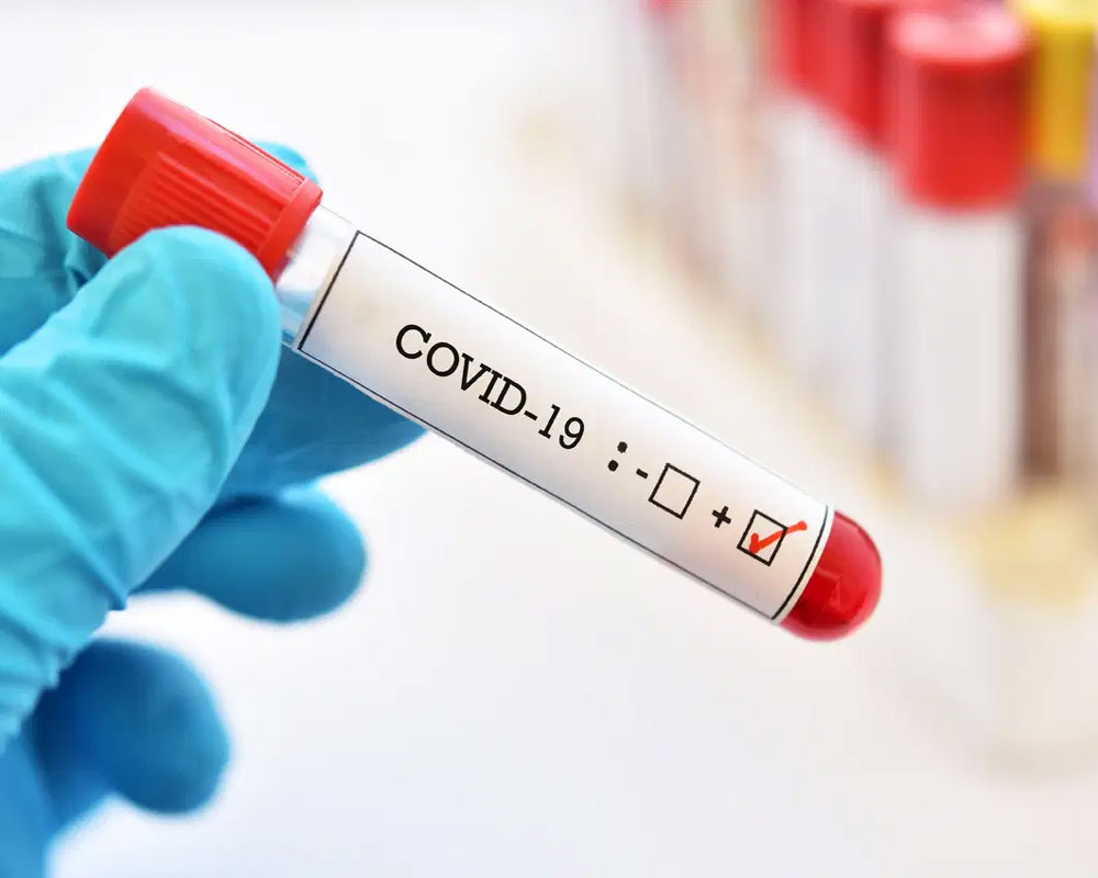 COVID-19 may lead to declines in life expectancy globally, study finds