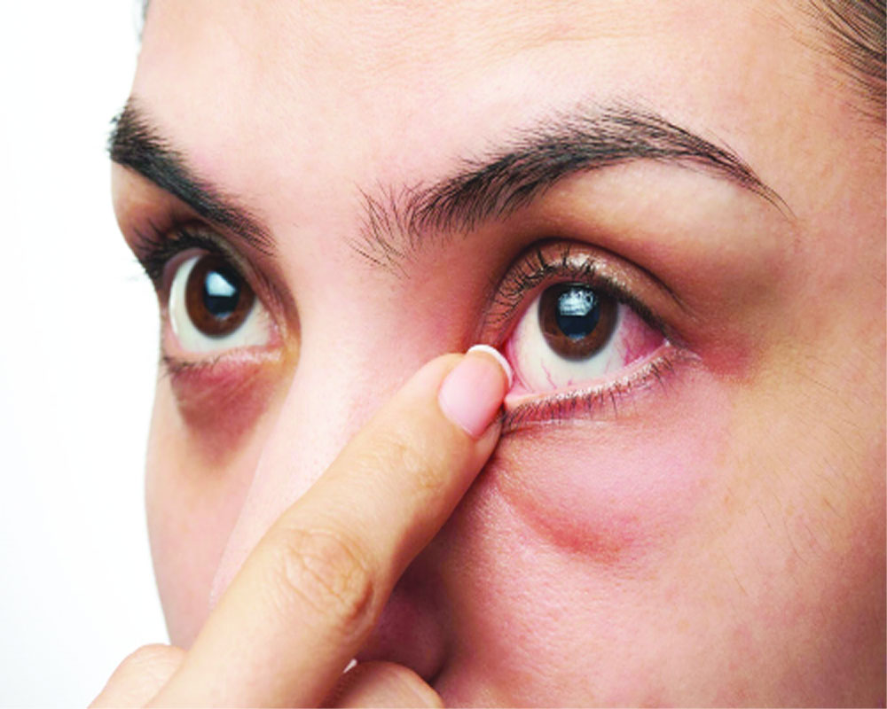 Dockyard : Keep an eye on your vision