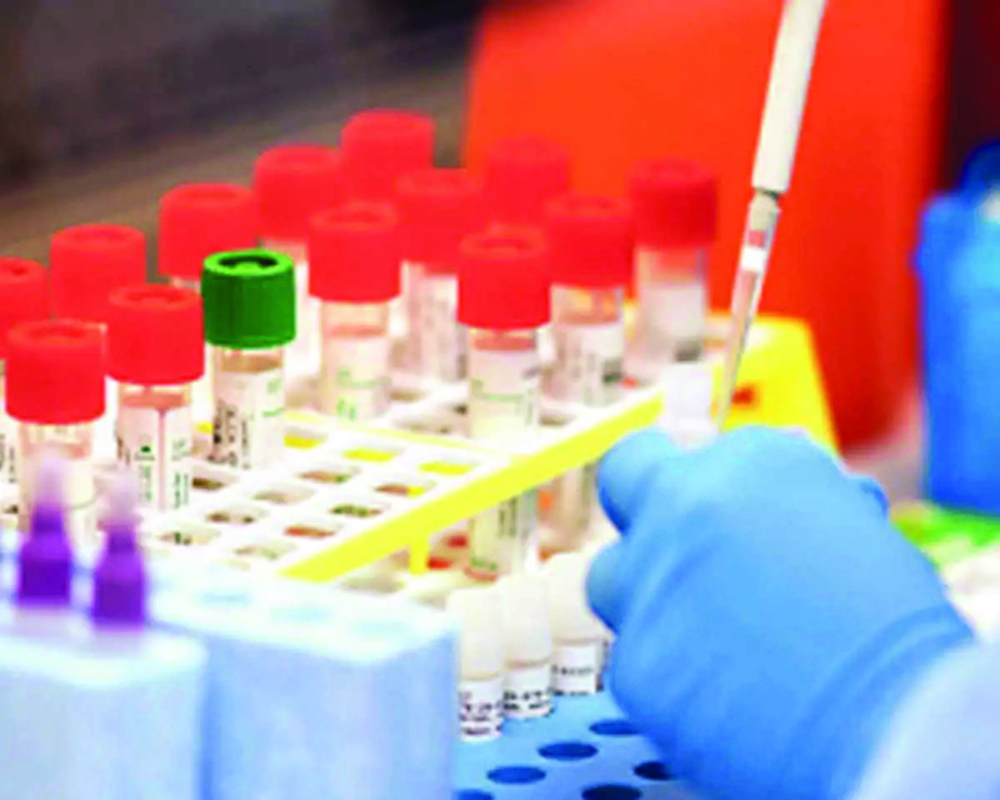 Genome sequencing  for 5% of +ve cases amid UK strain fear