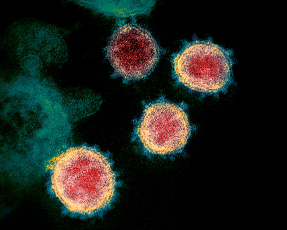New, more infectious strain of coronavirus now dominates global cases: Study
