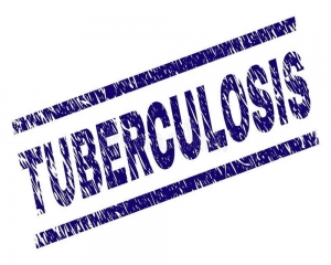 World TB Day: India's EndTB 2025 goal ambitious, herculean task, but achievable says Experts